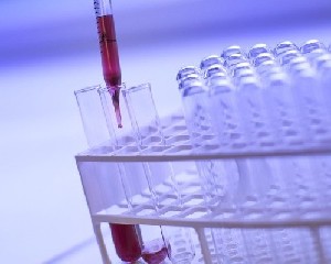 Израиль: опасная болезнь не отступает 