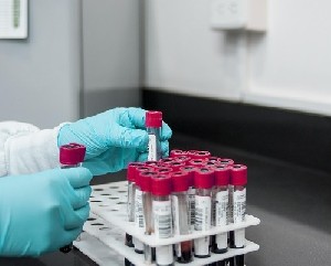 Разработан революционно новый анализ крови 